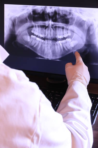 Best Emergency Treatment for Oral Infections in Cedar Creek, TX